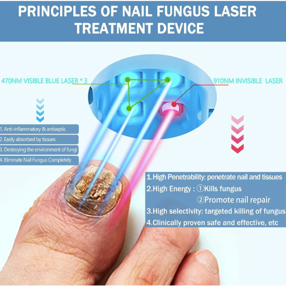 FungusFix™ Blue Light Therapy